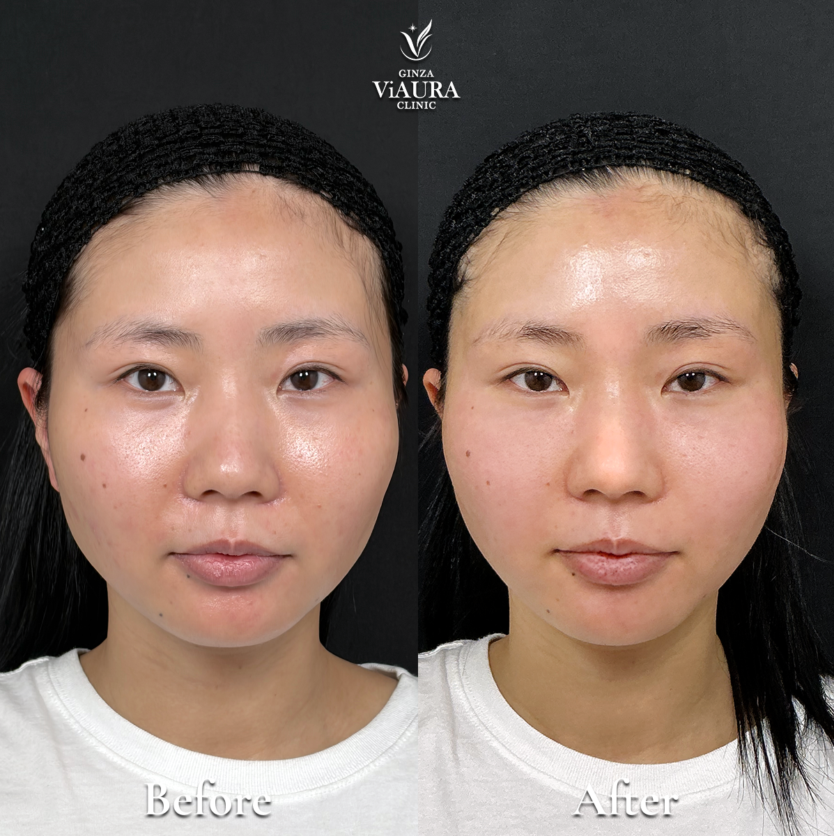症例写真