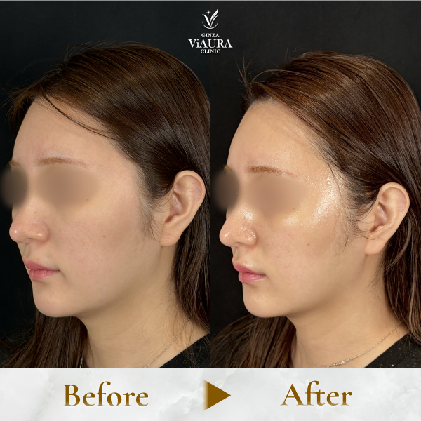 症例写真